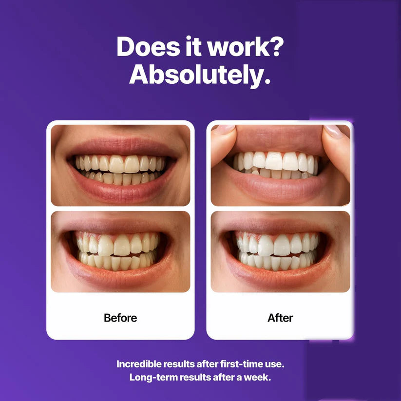 Purple Teeth Whitening Strips – Instant Whitening Power!